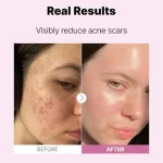 سرم نیاسینامید 15 درصد کوزارکس حجم 20 میل - Image 3