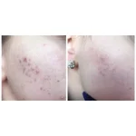 تونر روشن کننده حاوی AHA/BHA کوزارکس - Image 10