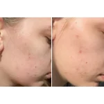 تونر روشن کننده حاوی AHA/BHA کوزارکس - Image 11