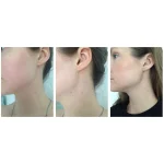 تونر روشن کننده حاوی AHA/BHA کوزارکس - Image 12