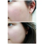تونر روشن کننده حاوی AHA/BHA کوزارکس - Image 7