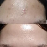 تونر روشن کننده حاوی AHA/BHA کوزارکس - Image 8