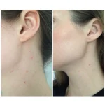 تونر روشن کننده حاوی AHA/BHA کوزارکس - Image 9