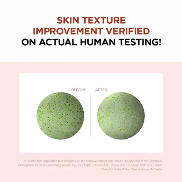 ماسک استیکی خاک رس کنترل منافذ سنتلا ماداگاسکار SKIN 1004 | حجم 27 گرم - Image 5